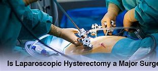 Laparoscopic Hysterectomy Là Gì